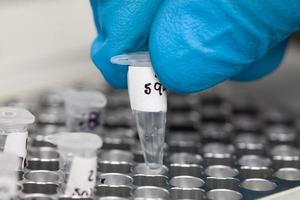 Closeup of a scientist hand while working at the laboratory with a thermal cycler. Polymerase chain reaction technique. PCR technique photo