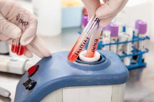 Scientist using a vortex to mix contents in a test tube. Scientist preparing bone marrow samples for flow cytometric analysis in the laboratory. photo