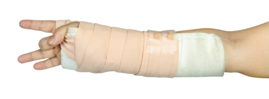 Hand making physical therapy to broken wrist from accident isolated png