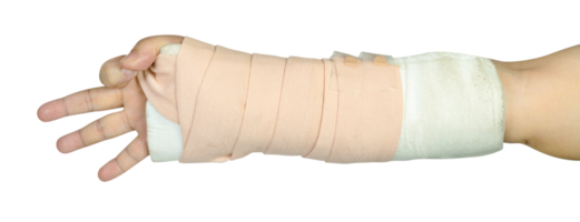 Hand making physical therapy to broken wrist from accident isolated png