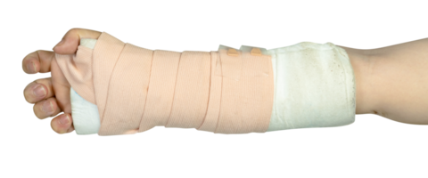 Hand Herstellung physisch Therapie zu gebrochen Handgelenk von Unfall isoliert png