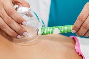 Doctor performing a moxibustion therapy on a young female patient back photo