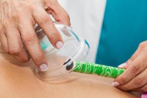 Doctor performing a moxibustion therapy on a young female patient back photo