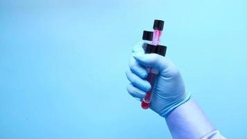 hand in blue medical gloves holding blood test tube top view video