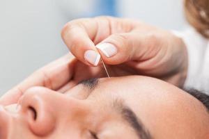 Doctor performing facial acupuncture on a young male patient photo