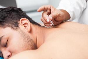 Doctor performing acupuncture on a young male patient photo