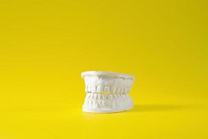 Jaw. Plaster model of the upper and lower jaw. Tooth model. High quality photo. photo