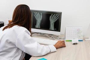 Traumatologist female doctor reviewing an x-ray of a patient's hands. Skeleton bone disease exam and medic aid. Career concept. photo