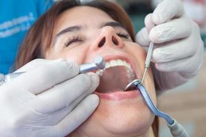 de cerca de un dental instrumentos siendo usado por el dentista durante un dental tratamiento para un hermosa mujer. foto