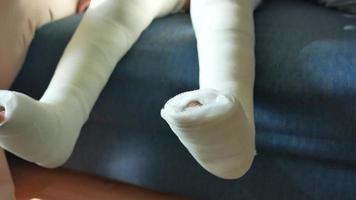 little child with plaster bandage on leg. video