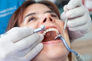 de cerca de un dental instrumentos siendo usado por el dentista durante un dental tratamiento para un hermosa mujer. foto