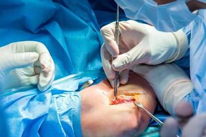 Group of orthopedic surgeons performing surgery on a patient arm photo