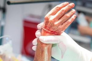 médico desinfectar el mano de un paciente previo a un mano cirugía foto
