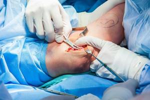 Group of orthopedic surgeons performing surgery on a patient arm photo