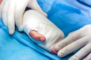 Surgeon bandaging the hand of a patient at the end of surgery photo