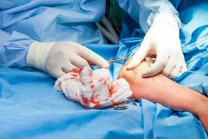 Surgeon suturing the arm of a patient at the end of surgery photo