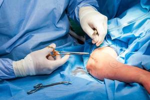 cirujano sutura el brazo de un paciente a el final de cirugía foto