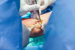 Group of orthopedic surgeons performing surgery on a patient arm photo