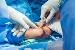 Group of orthopedic surgeons performing surgery on a patient arm photo