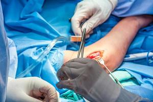 Group of surgeons performing an elbow surgery photo