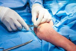 cirujano sutura el brazo de un paciente a el final de cirugía foto