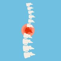 Problems with spine. Posture issues. Sick red place. Crack in White bone. Magnifying glass. Logo in circle. Vertebral column. X-ray of internal organs. Medical care. Fracture of intervertebral discs vector