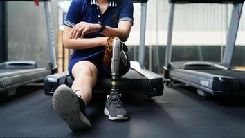 Young female with one prosthetic leg with the practice of using prosthetic legs to walk, exercise and and daily activities photo