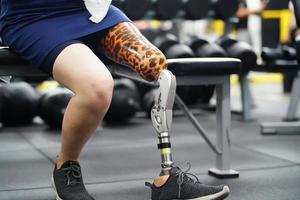 joven hembra con uno protésico pierna con el práctica de utilizando protésico piernas a caminar, ejercicio y y diario ocupaciones foto