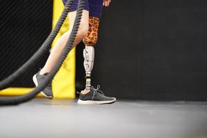 Young female with one prosthetic leg with doing arm and shoulder exercises with a rope to practice balancing with prosthetic leg, Concept of life of women with prosthetic legs. photo