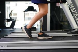 Young female with one prosthetic leg with exercise by walking on a treadmill to practice walking with the other prosthetic leg to be more flexible. photo