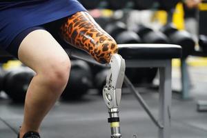 Young female with one prosthetic leg with the practice of using prosthetic legs to walk, exercise and and daily activities photo