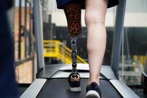 Young female with one prosthetic leg with exercise by walking on a treadmill to practice walking with the other prosthetic leg to be more flexible. photo