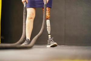 Young female with one prosthetic leg with doing arm and shoulder exercises with a rope to practice balancing with prosthetic leg, Concept of life of women with prosthetic legs. photo