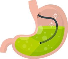 gastroscopia. endoscopia y digestivo problemas. manguera con cámara. procedimiento con interno órganos dibujos animados plano ilustración. médico visual inspección de estómago vector