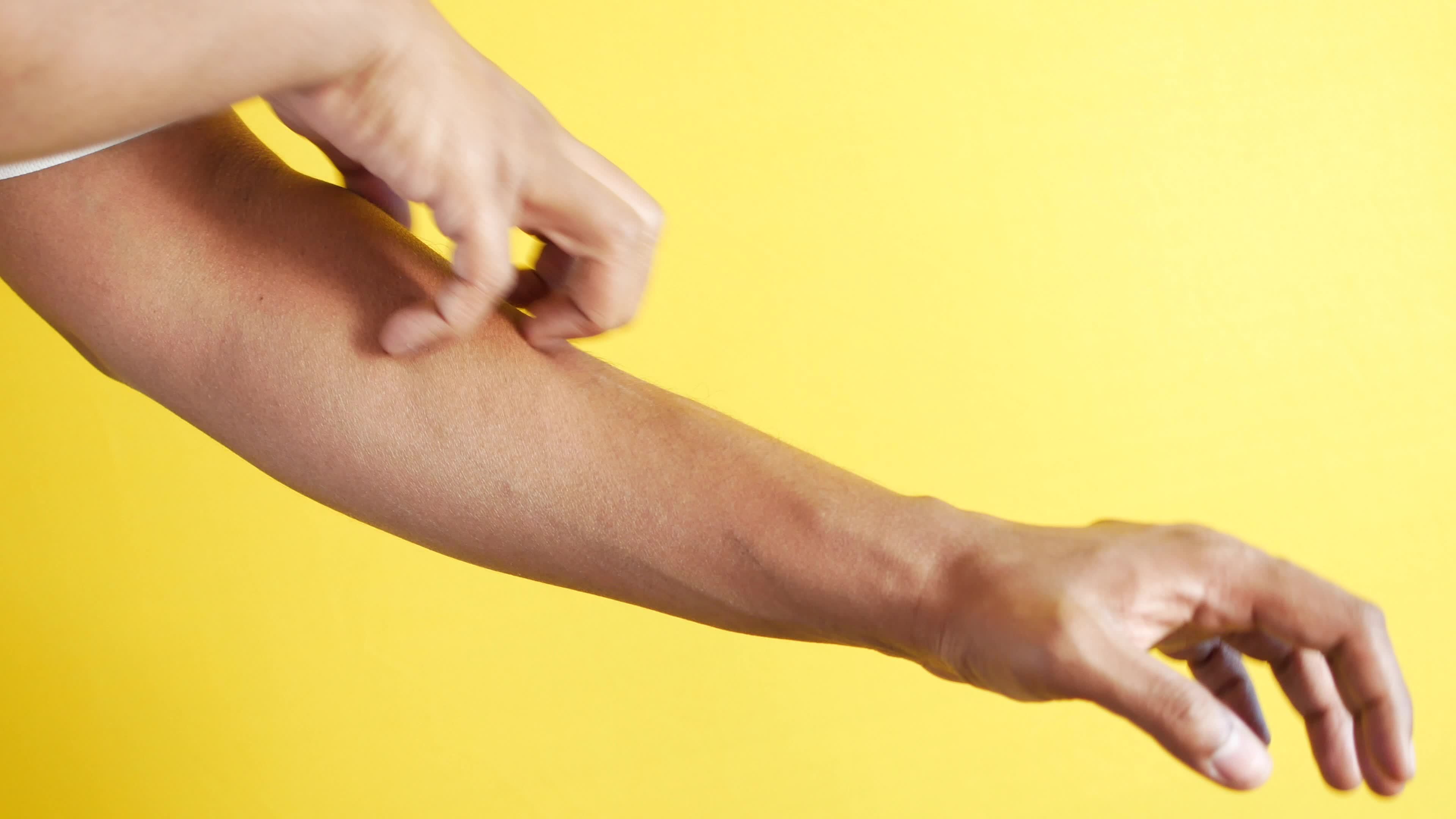 man-suffering-from-itching-skin-close-up-23030495-stock-video-at-vecteezy