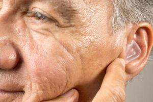 Older Man using custom made silicone earplugs for hearing protection photo