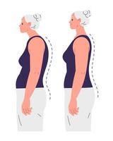 mayor mujer con dañado postura y correcto postura vector