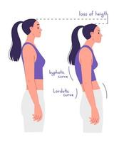 Correct and incorrect posture. The disadvantages of poor posture and the consequences of scoliosis vector