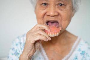 Asian elderly woman patient holding to use denture, healthy strong medical concept. photo