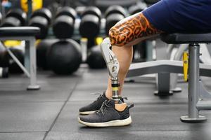 joven hembra con uno protésico pierna con el práctica de utilizando protésico piernas a caminar, ejercicio y y diario ocupaciones foto