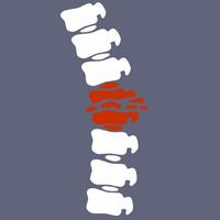 Problems with spine. Posture issues. Sick red place. Crack in White bone. Magnifying glass. Logo in circle. Vertebral column. X-ray of internal organs. Medical care. Fracture of intervertebral discs vector