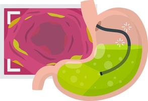 gastroscopia. endoscopia y digestivo problemas. manguera con cámara. procedimiento con interno órganos dibujos animados plano ilustración. médico visual inspección de estómago vector