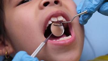 närbild i de oral hålighet av en friska barn med skön vit tänder. ung flicka öppnas henne mun till avslöja friska tänder, hård och mjuk gom. dental och oral hälsa kolla upp video
