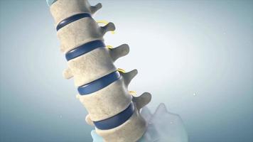 3d animación de un humano lumbar espina demostrando herniado desct, presión nervio raíz causando espalda dolor video
