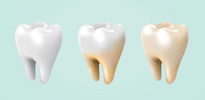 antes de y después de blanqueo tratamiento, desde blanco a amarillo dientes en 3d ilustración vector