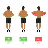 The push up dominant muscle. How to do push up from top view. Hand position. Chest and tricep or injury dominant. Neutral position and internal rotation. Flat vector illustration isolated on white