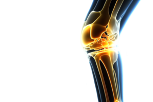 Knee injury illuminated by neon light. Skeleton of human leg. Transparent Background png