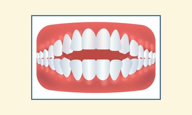 Open Bite Teeth Icon Against Yellow Background.