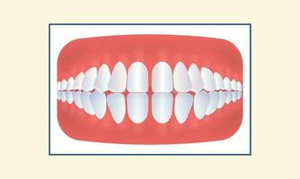 excesivo espaciado dientes icono en amarillo antecedentes. vector