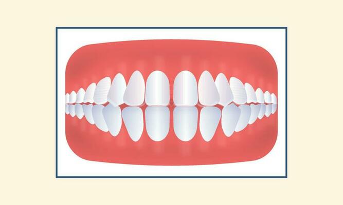 Excessive Spacing Teeth Icon On Yellow Background.